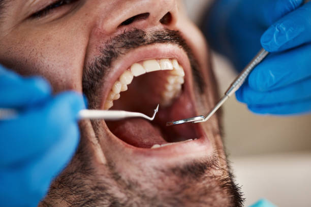 Best Emergency Tooth Extraction in Strathmore, CA